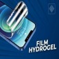 Film Hydrogel sur mesure